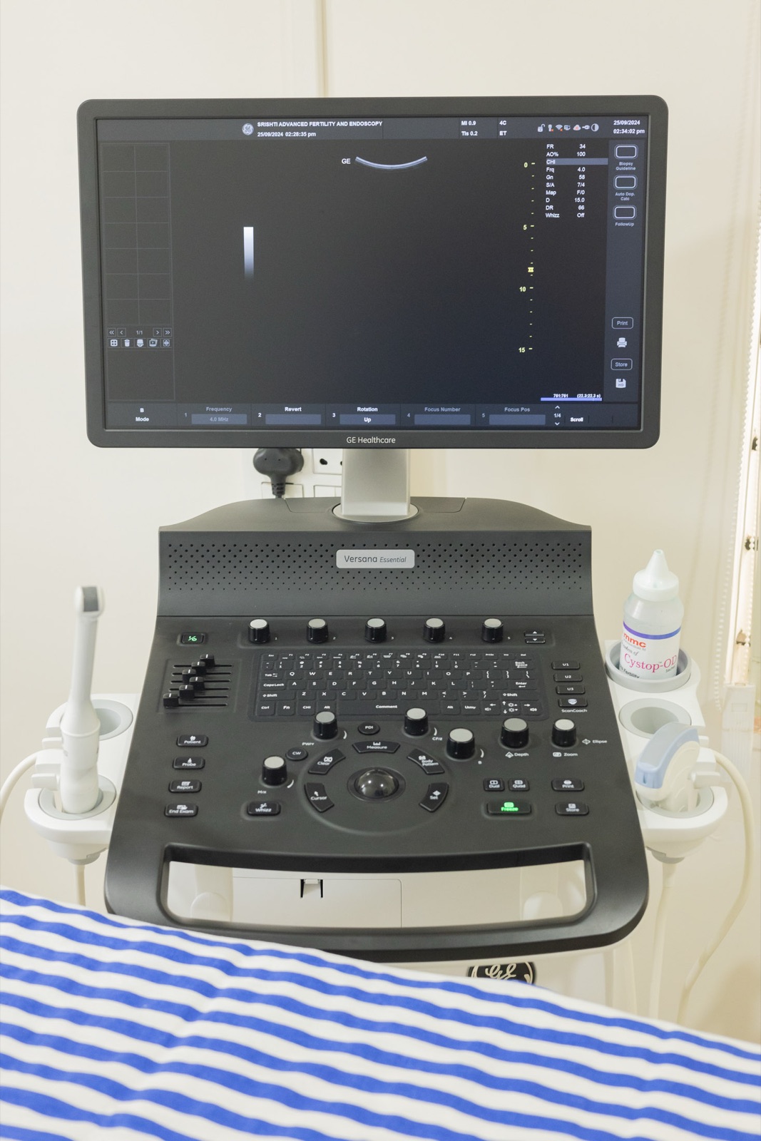 GE Healthcare Versana ultrasound system displaying Srishti SAFE patient interface